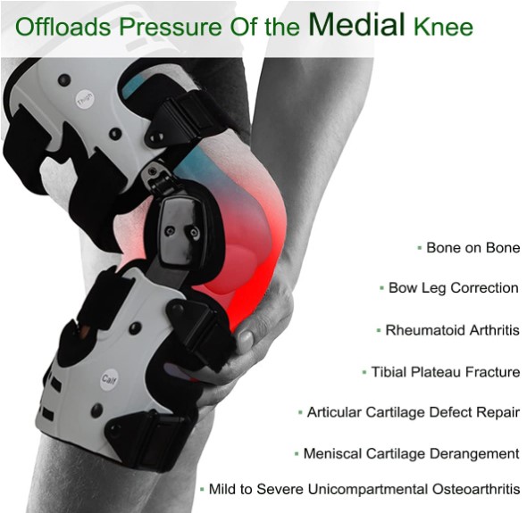 Best Knee Braces For Arthritis - Buying Guide - Orthomen