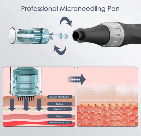 3 Best Microneedling Pens - Fxtiaa Professional Microneedling Pen
